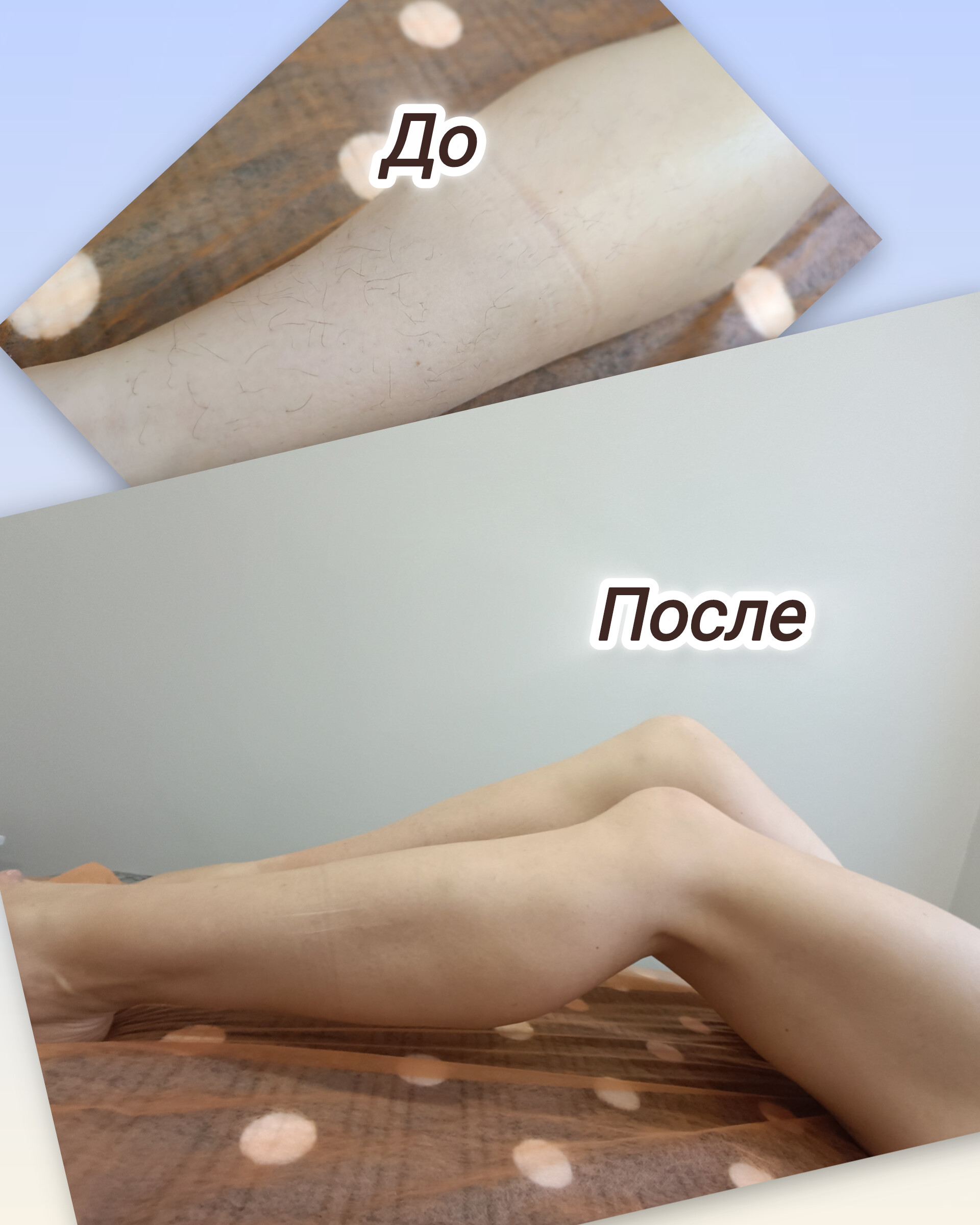 Шугарінг ніг